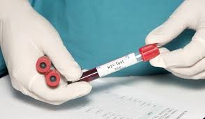 Cazuri de HIV in Dolj