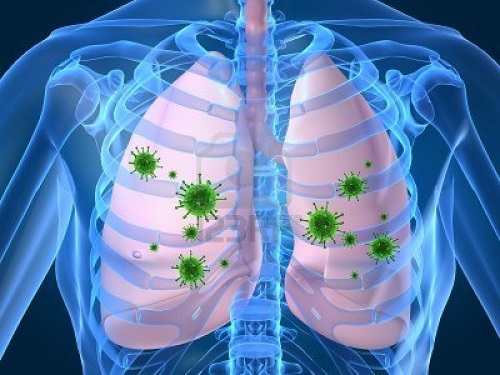 (Audio) Cazurile de infectii respiratorii grave, in crestere