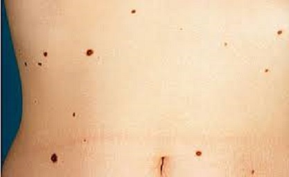 Alunitele – intre mit si realitate