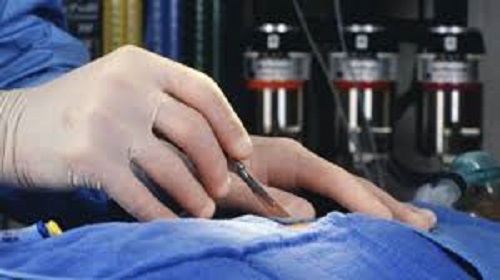 Premiere chirugicale la Novaci