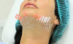 Cum scapi de riduri in cateva minute