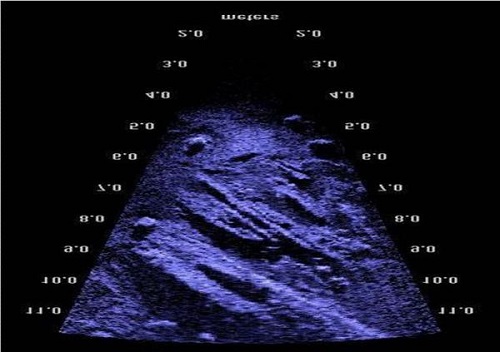 Mica Atlantidă a Angliei