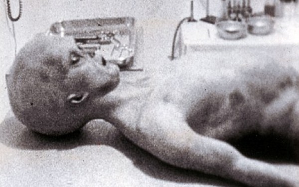 Proză SF – Autopsia