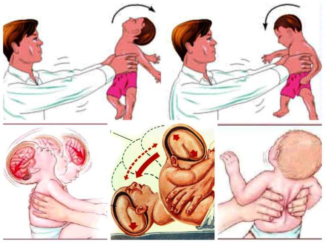 Atentie la Sindromul copilului zgaltait!