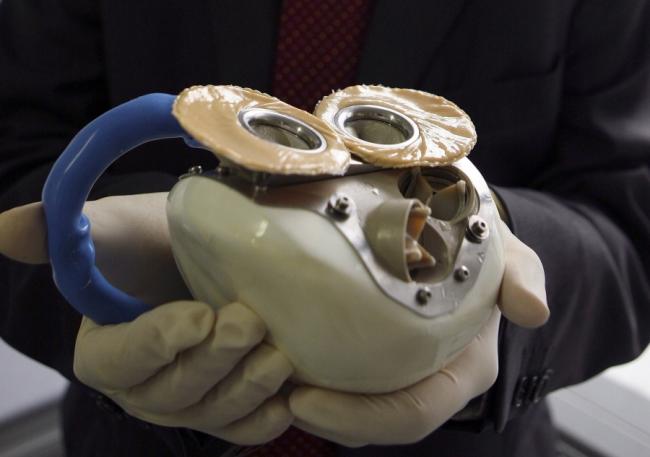 Proteza cu inima artificiala nu i-a fost de ajutor unui pacient