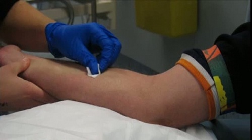 Terapie nouă pentru cancer