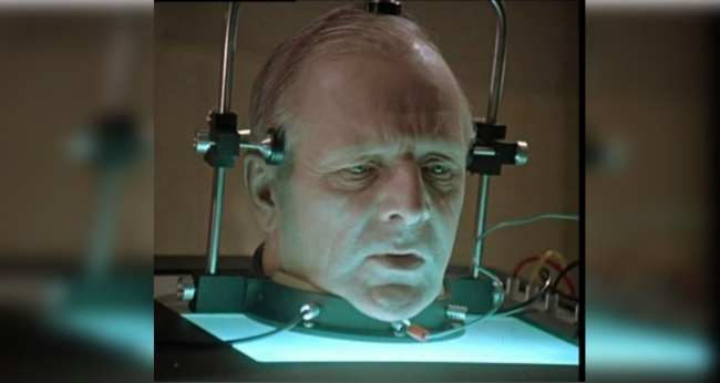 Un doctor chinez va efectua transplantul unui cap uman