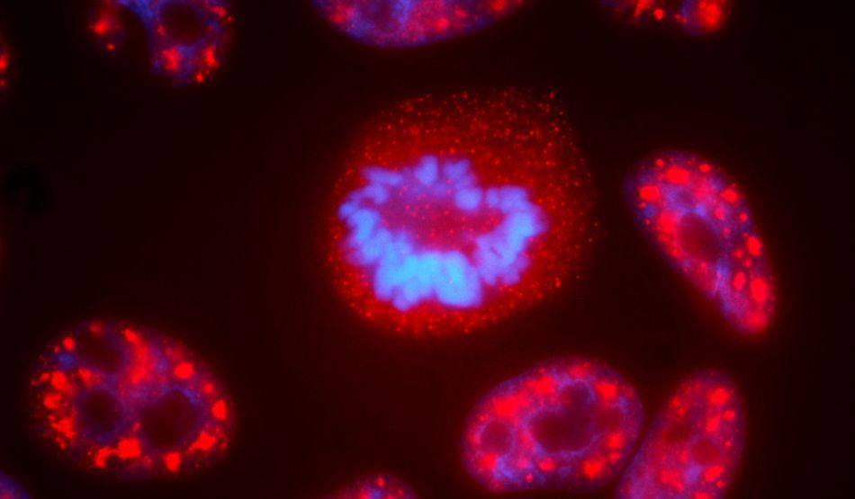 Savanţii au făcut o descoperire de proporţii legată de cancer.