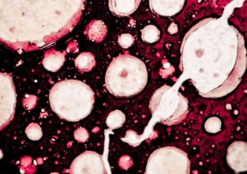 Cinci alimente care distrug celulele canceroase