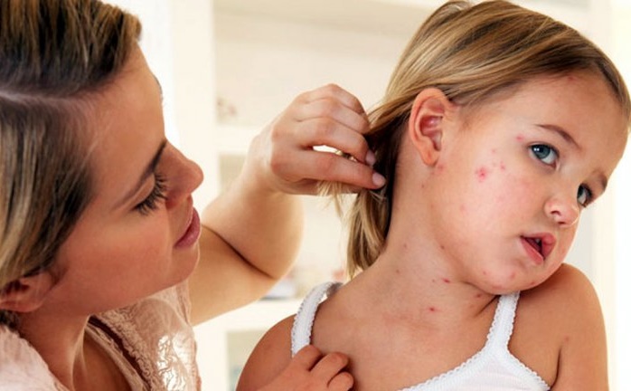 Numărul bolnavilor de rujeolă, în continuă creştere