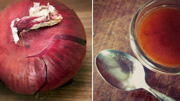 Remediu tradițional