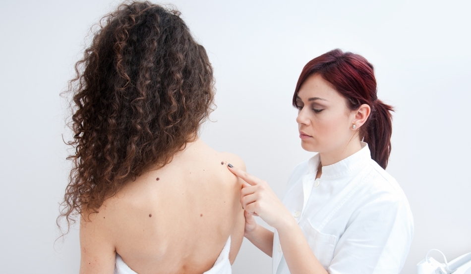 Oamenii сu aluniţe trăiesc mai mult