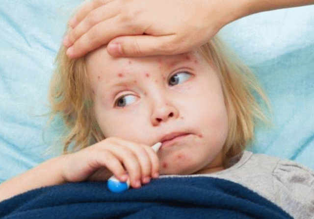 Rujeola face o nouă victimă