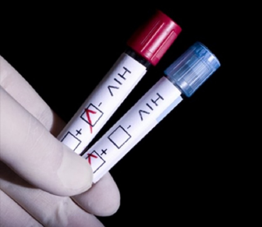 În Dolj, 6 persoane au fost depistate cu HIV