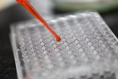 Criza de imunoglobulină