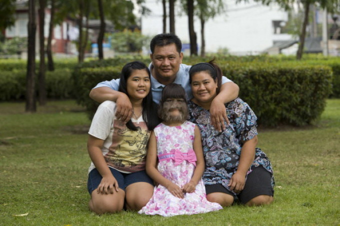 ”Cea mai păroasă fetiță din lume” s-a căsătorit și s-a ras pentru soțul ei