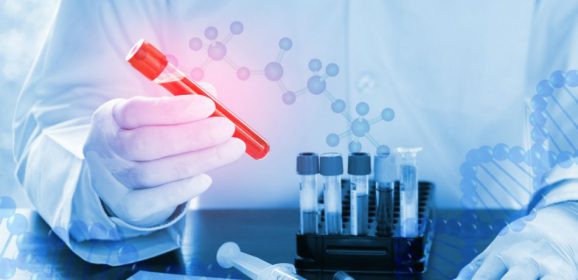 A fost elaborat un nou test pentru detectarea cancerului