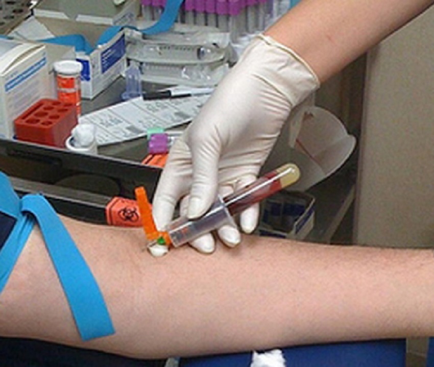 Analizele de depistare a infecţiei cu virusul hepatic B sau C vor fi gratuite (audio)