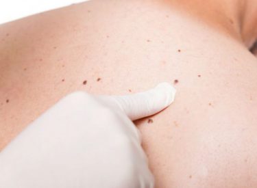 Medici americani în sprijinul colegilor români