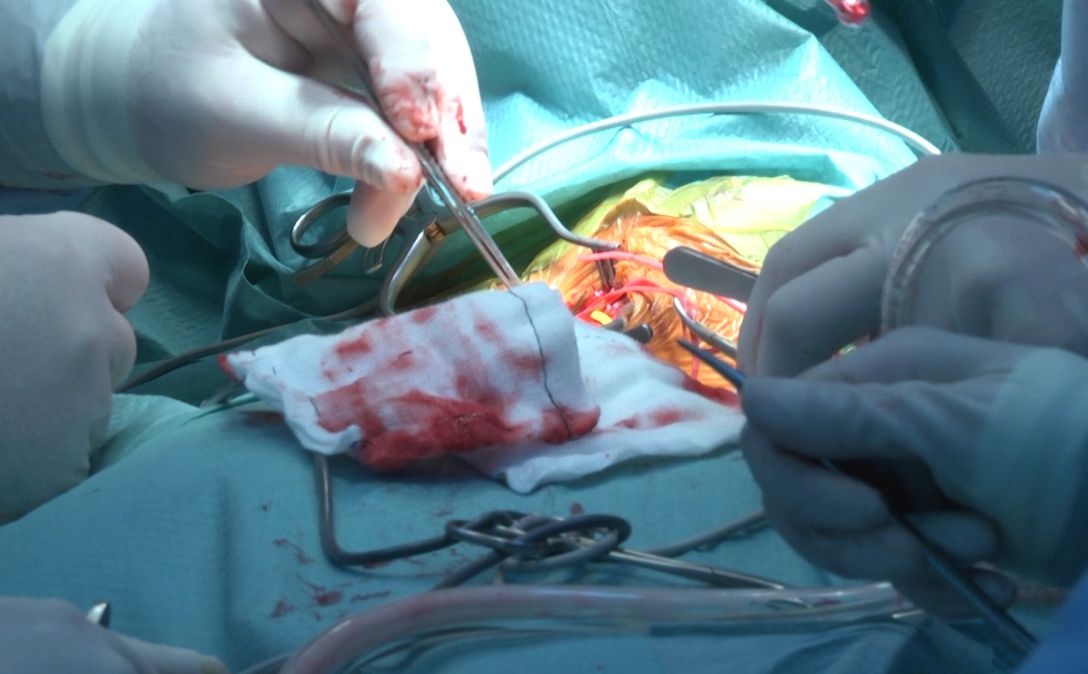 Ziua Donatorului de Organe (audio)