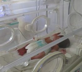 Dotări moderne pentru tratarea nou-născuților