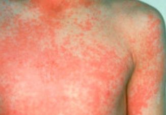 Alertă la CN „Carol I“ din Craiova