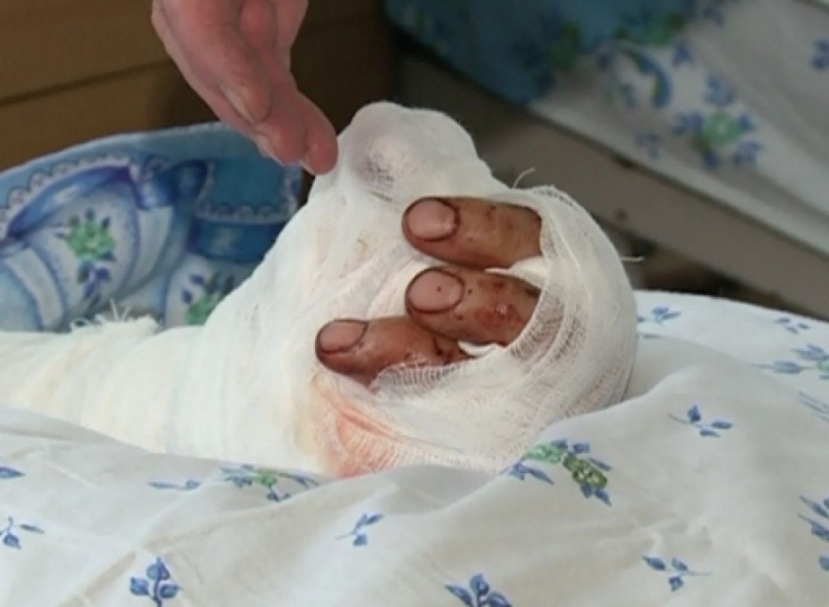 O femeie şi-a retezat mâna pentru a încasa despăgubiri