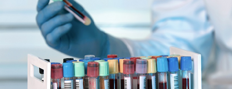 Semne de întrebare asupra prețurilor pentru testele Covid