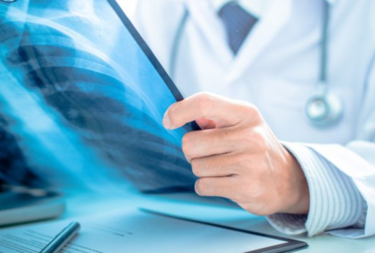 Vâlcea: este nevoie de medici radiologi